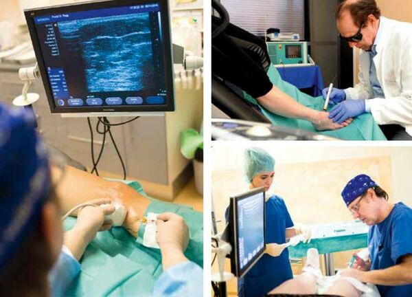 Venenbehandlung mit Ultraschall