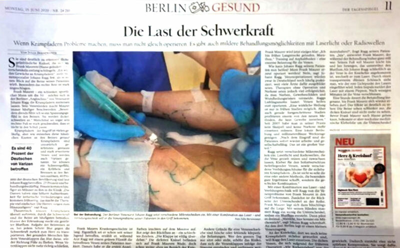 Dr. Ragg angioclinic im Tagesspiegel zu Venenerkrankungen